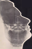 Journal of Upper Cervical Chiropractic Research